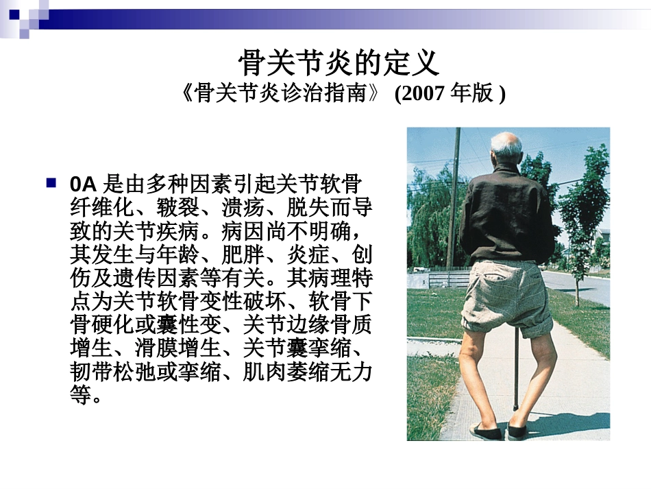 骨关节炎治疗_第2页
