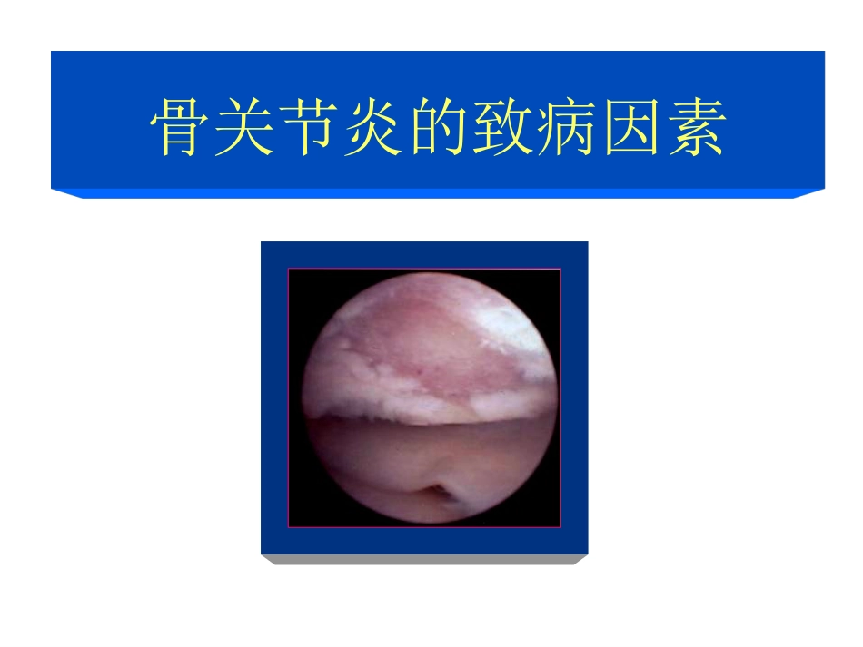 骨关节炎治疗_第4页
