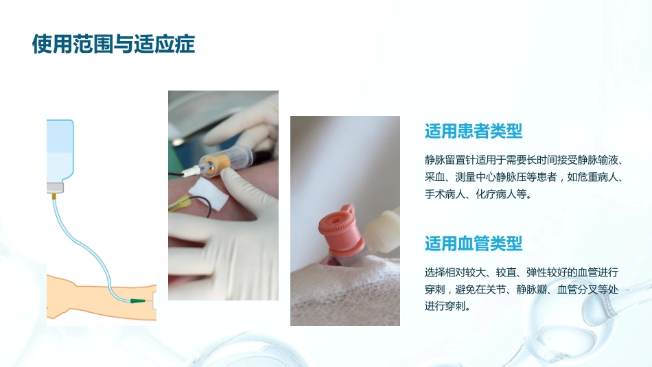 静脉留置针常见并发症预防及处理_第5页