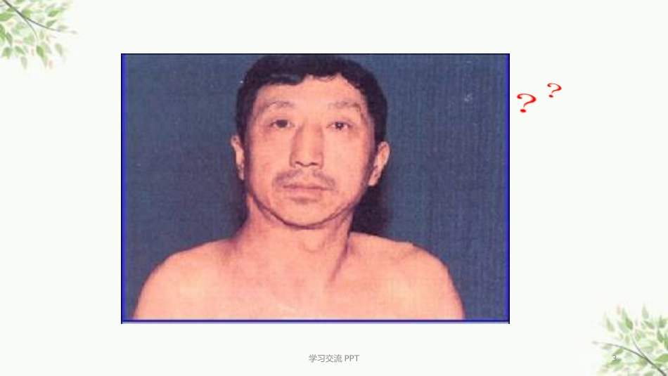 病理学淋巴造血系统疾病医学PPT课件_第3页