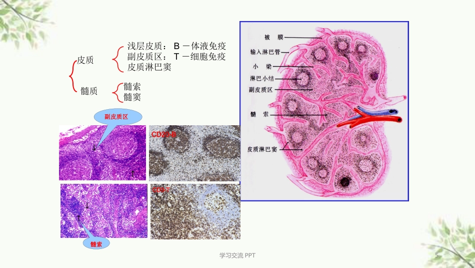 病理学淋巴造血系统疾病医学PPT课件_第5页