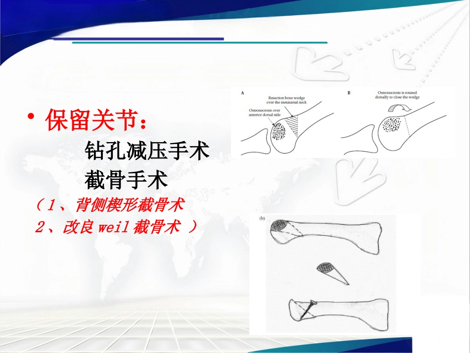 Freiberg病的诊断治疗_第15页