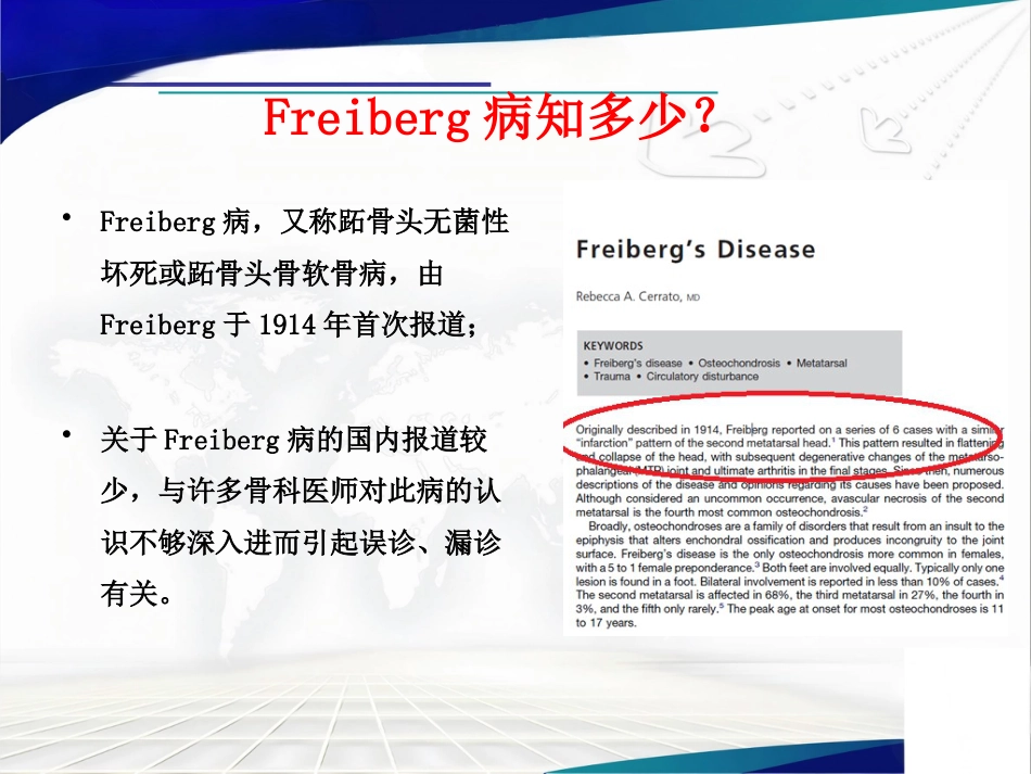 Freiberg病的诊断治疗_第4页