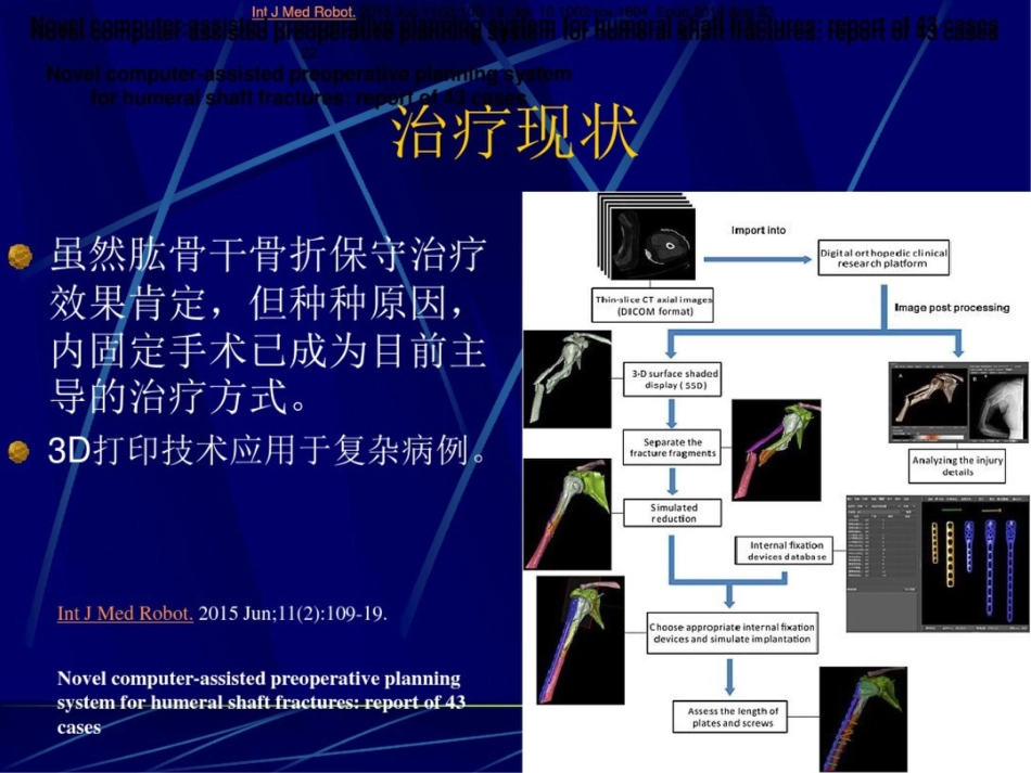 肱骨干骨折保守治疗的技巧与陷阱_第13页