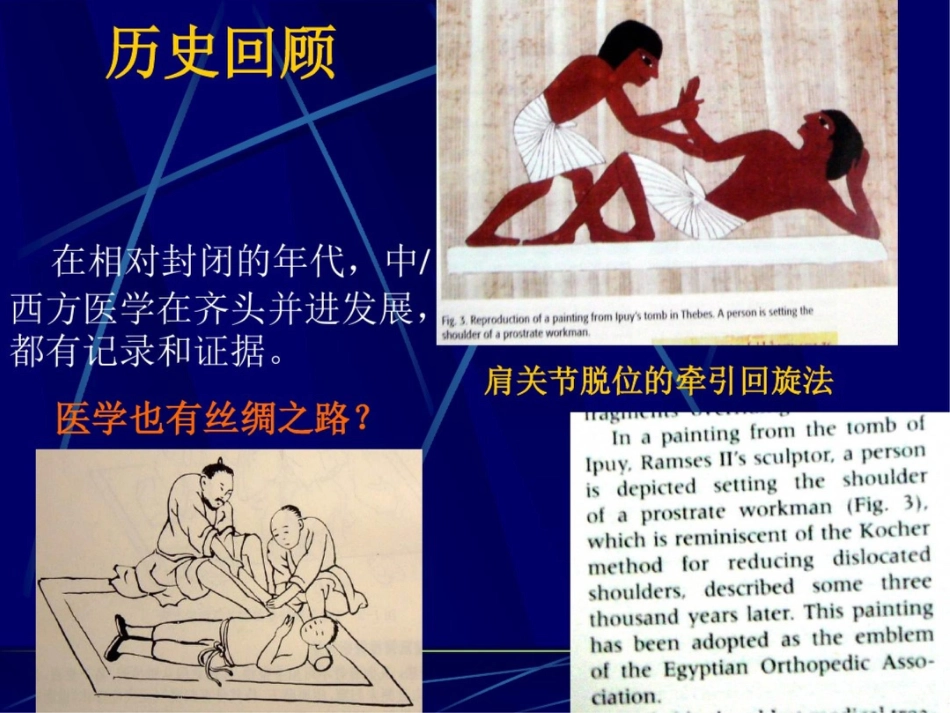 肱骨干骨折保守治疗的技巧与陷阱_第4页