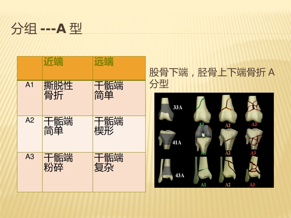 骨折AO分型_第13页