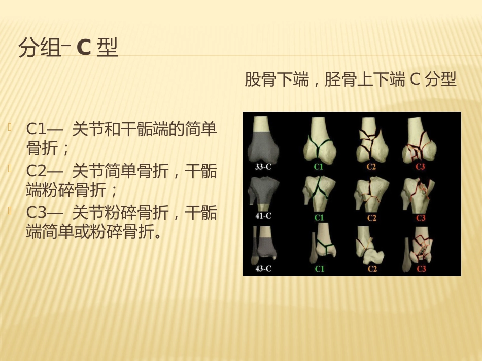 骨折AO分型_第15页