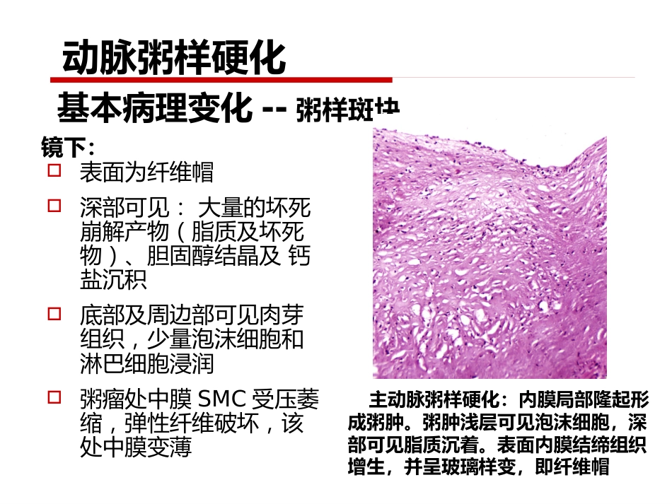 病理学 心血管系统疾病_第13页