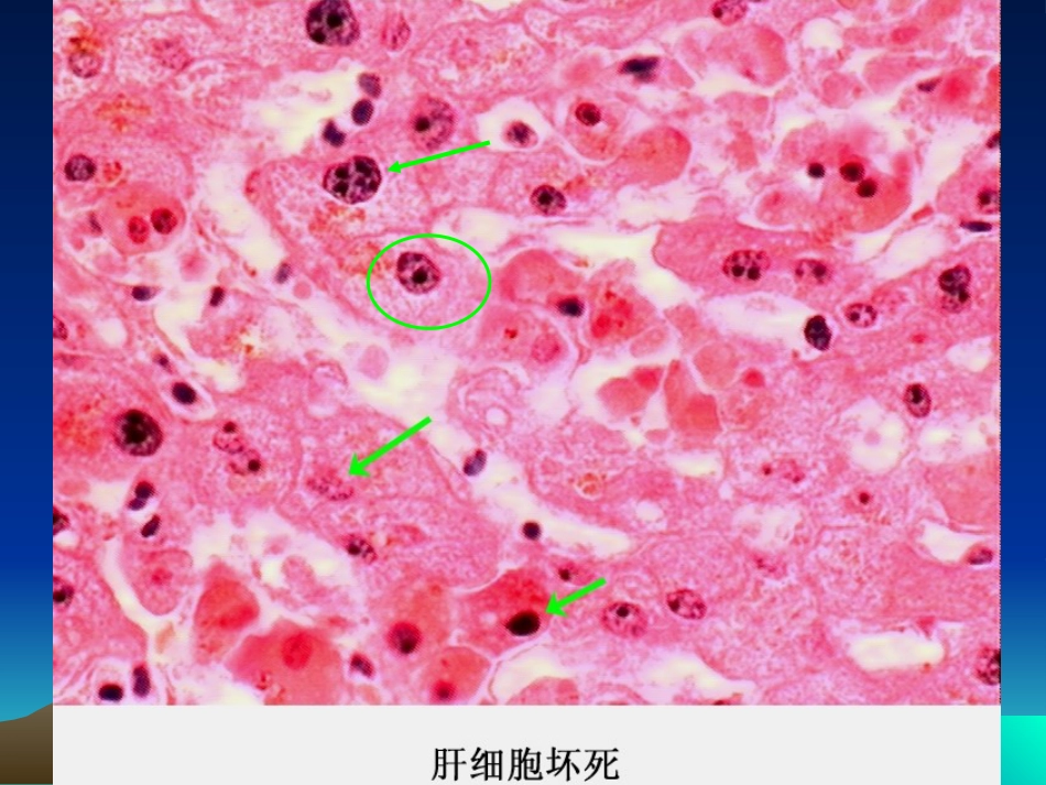 病理学基础-变性与坏死-兽医学概论(动物科学专业使用)_第12页