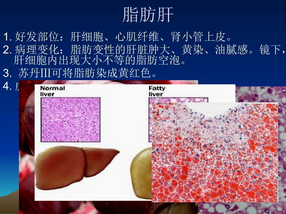 病理学基础-变性与坏死-兽医学概论(动物科学专业使用)_第14页