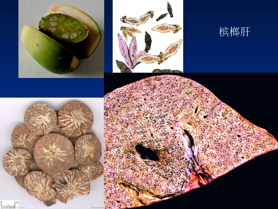 病理学基础-变性与坏死-兽医学概论(动物科学专业使用)_第15页