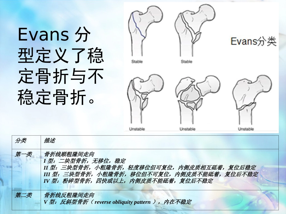 股骨粗隆间骨折 股骨转子间骨折_第13页