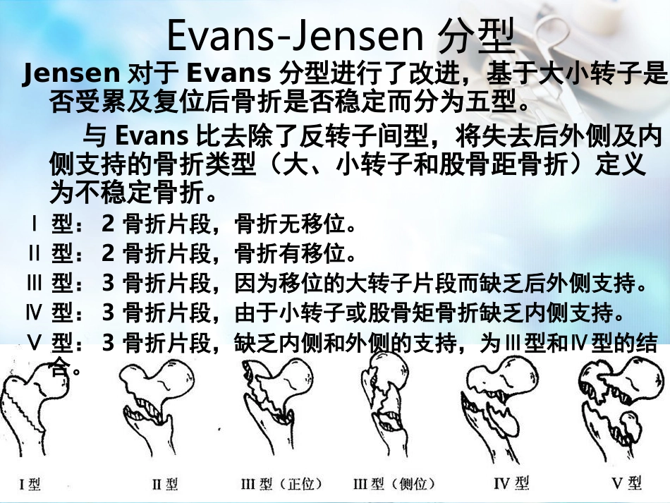 股骨粗隆间骨折 股骨转子间骨折_第14页