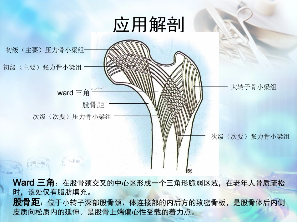 股骨粗隆间骨折 股骨转子间骨折_第5页