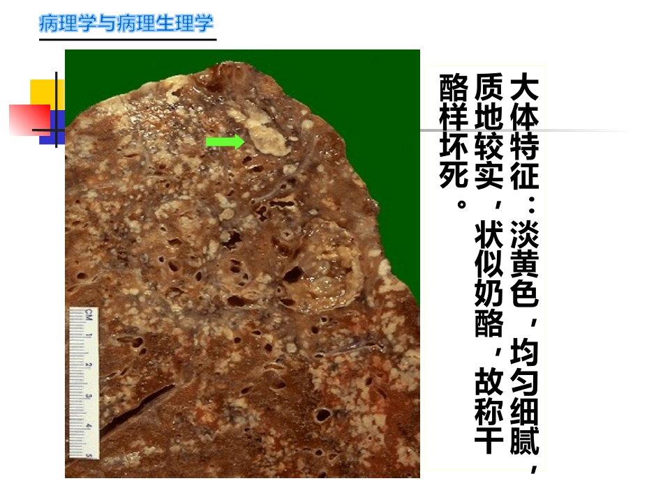 病理学-传染病_第10页