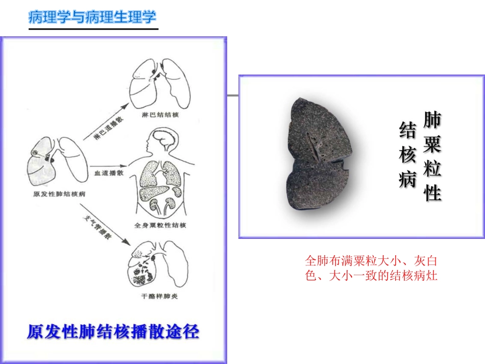 病理学-传染病_第14页