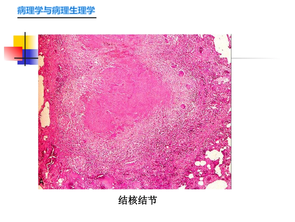 病理学-传染病_第7页