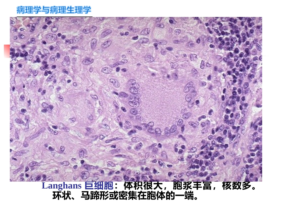 病理学-传染病_第8页