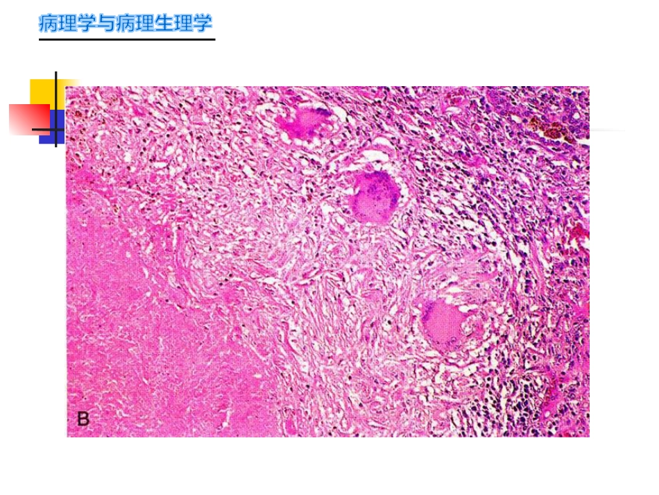 病理学-传染病_第9页