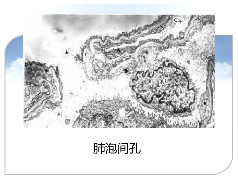 病理学课件PPT 呼吸系统疾病_第5页