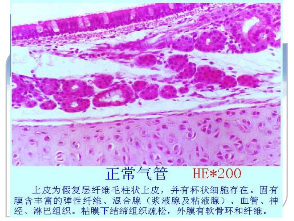 病理学课件PPT 呼吸系统疾病_第7页