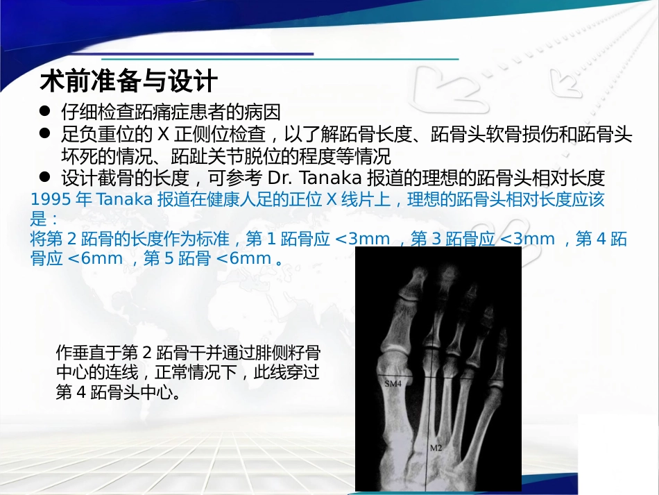 Weil截骨术与Jacoby截骨术_第4页