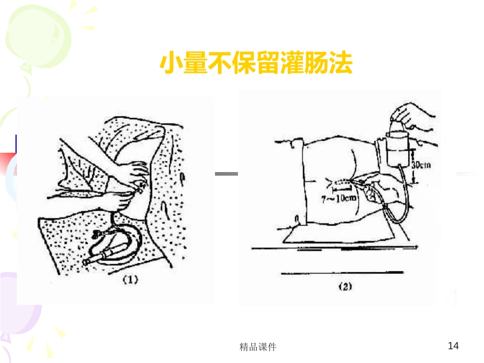 灌肠完整PPT课件_第14页