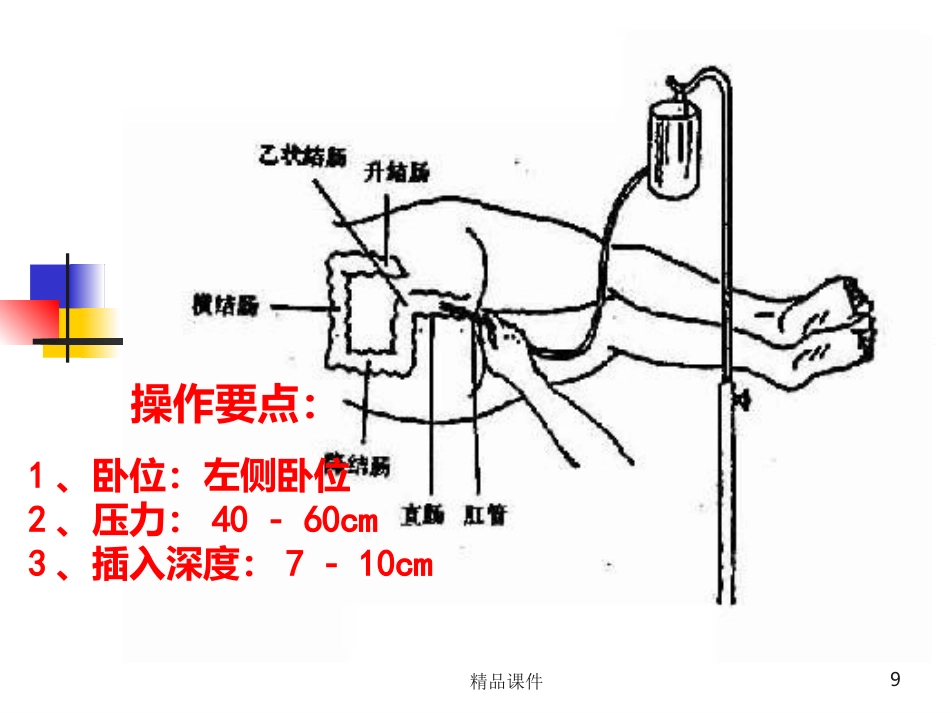 灌肠完整PPT课件_第9页