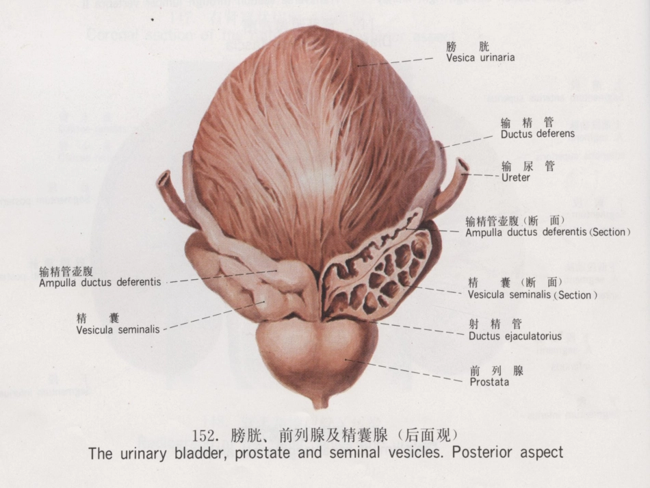 膀胱疾病病理学ppt课件_第6页