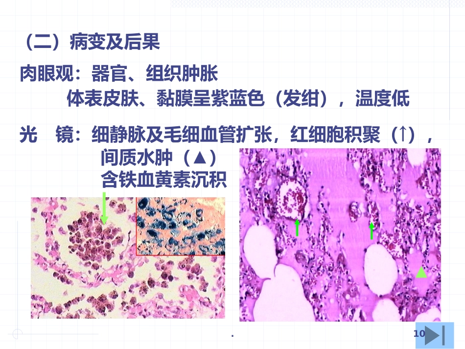 病理学局部血液循环障碍ppt课件_第10页
