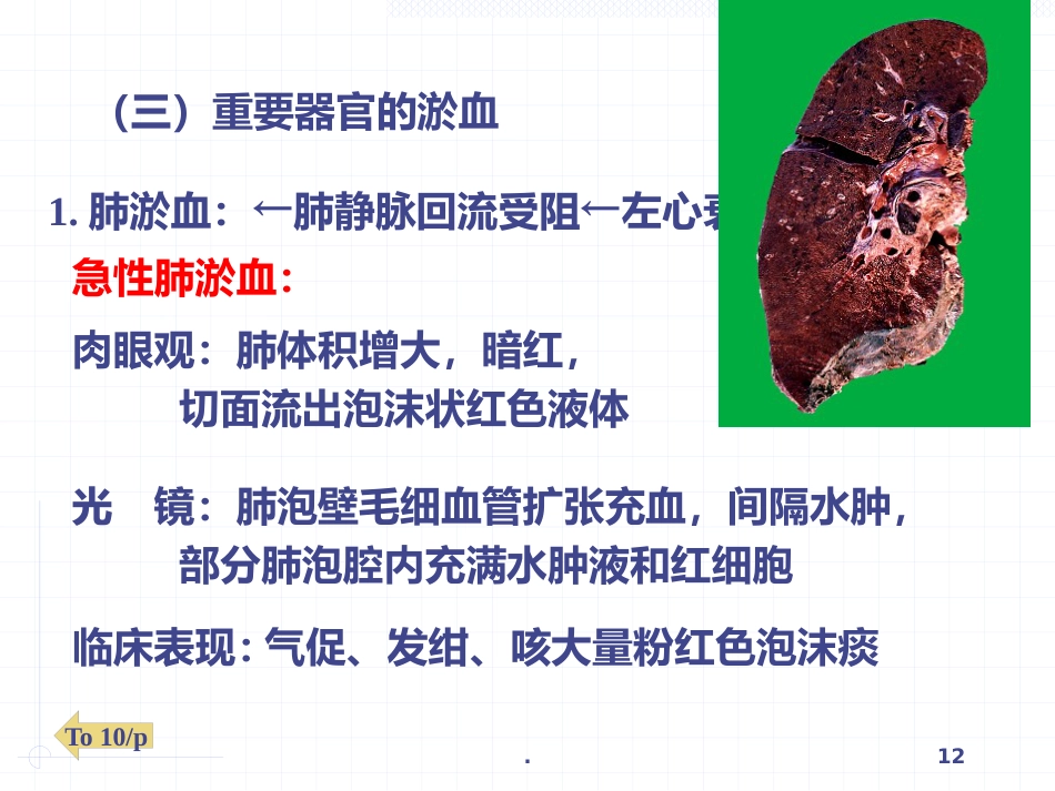 病理学局部血液循环障碍ppt课件_第12页