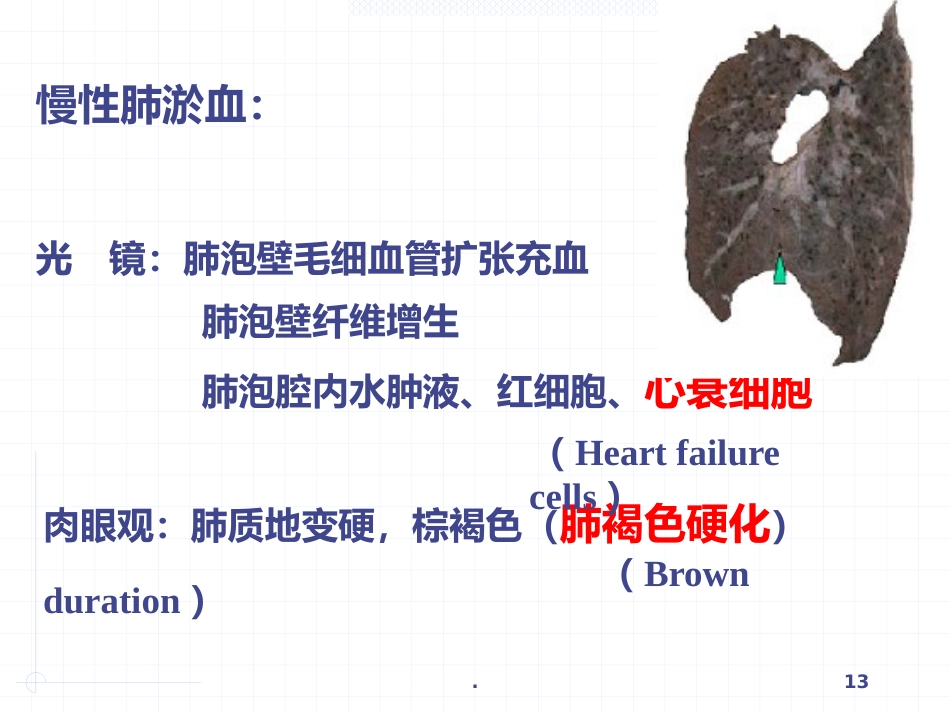 病理学局部血液循环障碍ppt课件_第13页
