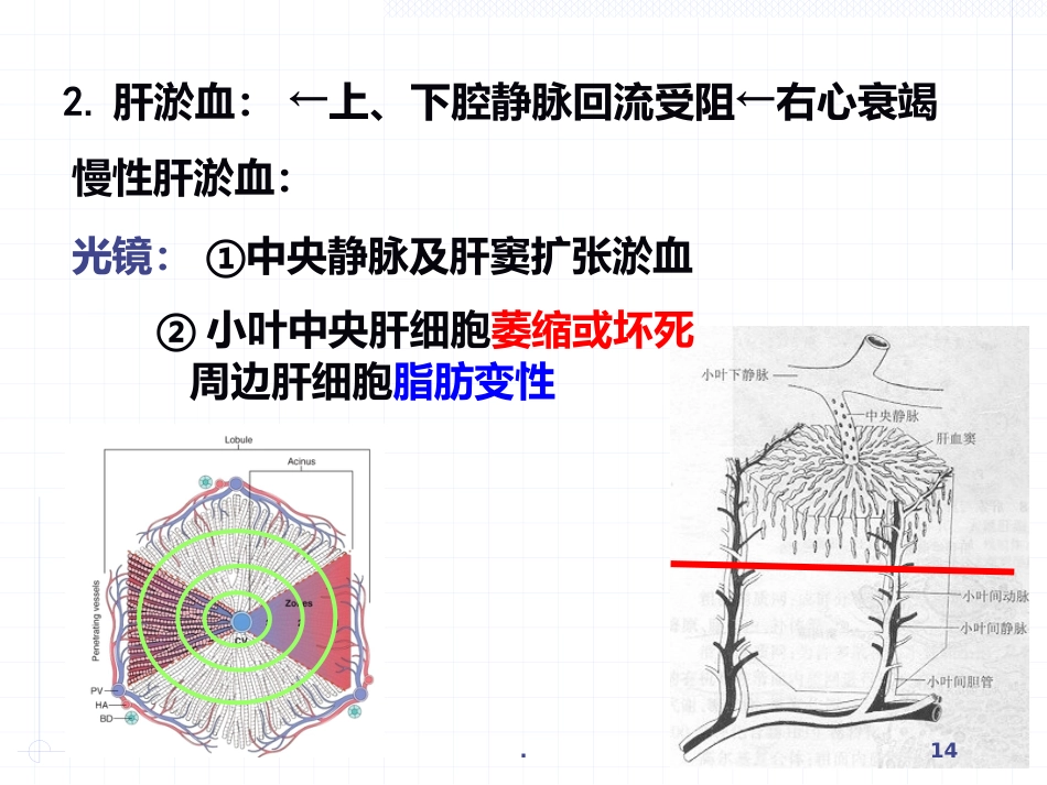 病理学局部血液循环障碍ppt课件_第14页