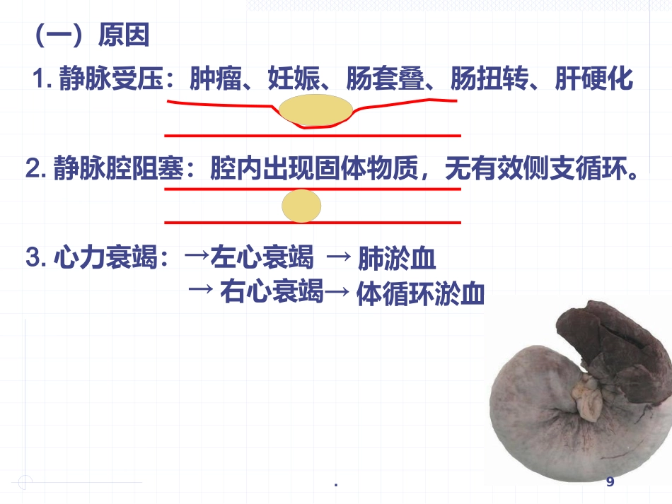 病理学局部血液循环障碍ppt课件_第9页