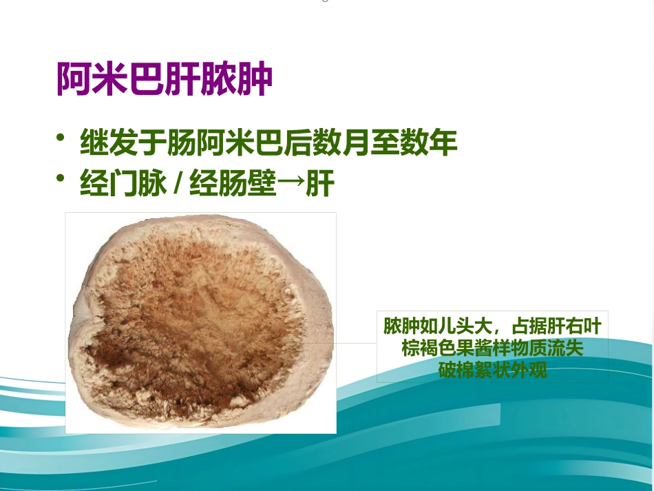病理学-寄生虫_第10页