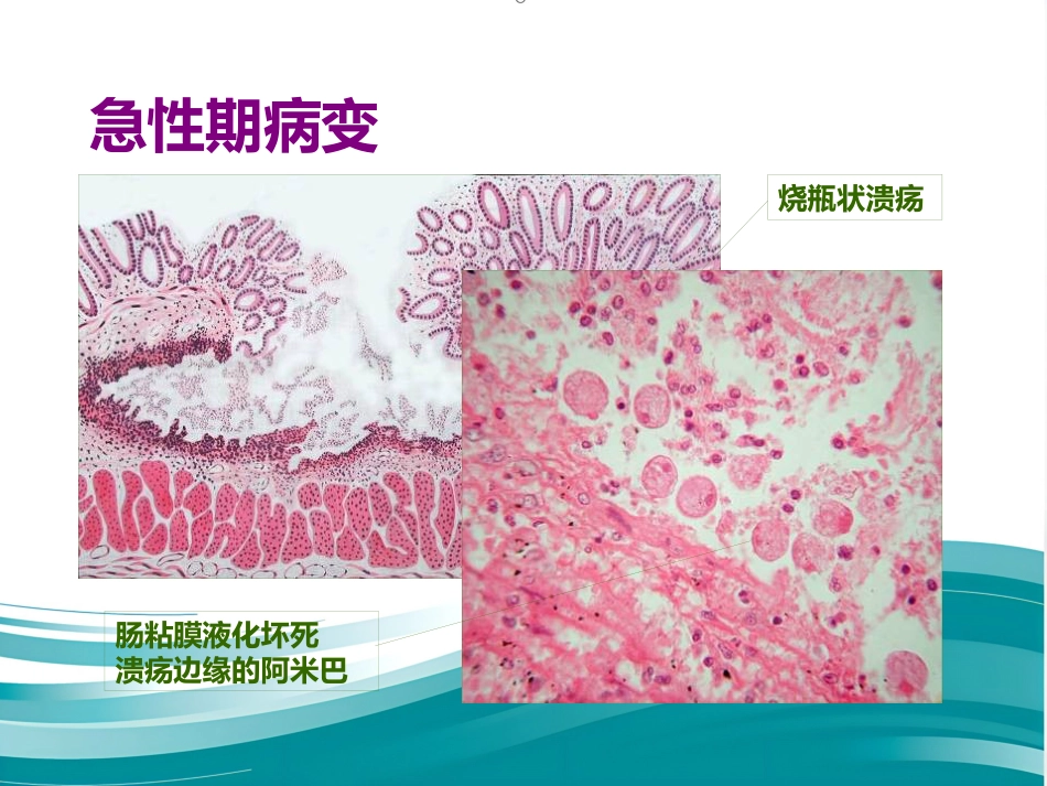 病理学-寄生虫_第6页