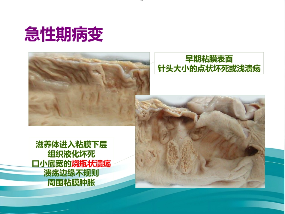 病理学-寄生虫_第7页