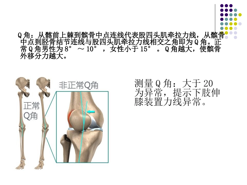 复发性髌骨脱位_第14页