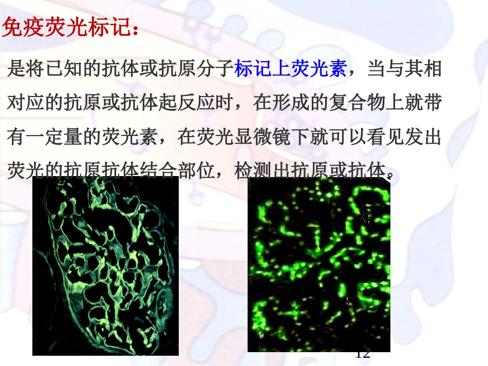 病理学泌尿系统疾病_第10页
