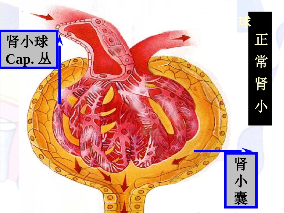 病理学泌尿系统疾病_第5页
