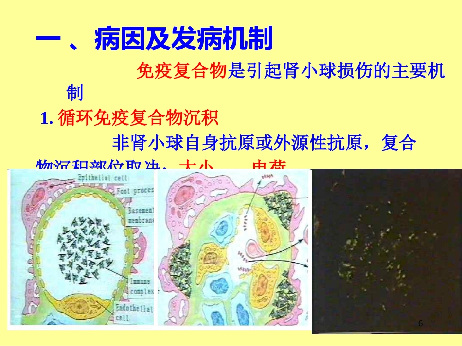 病理学泌尿系统疾病ppt课件ppt演示课件_第6页