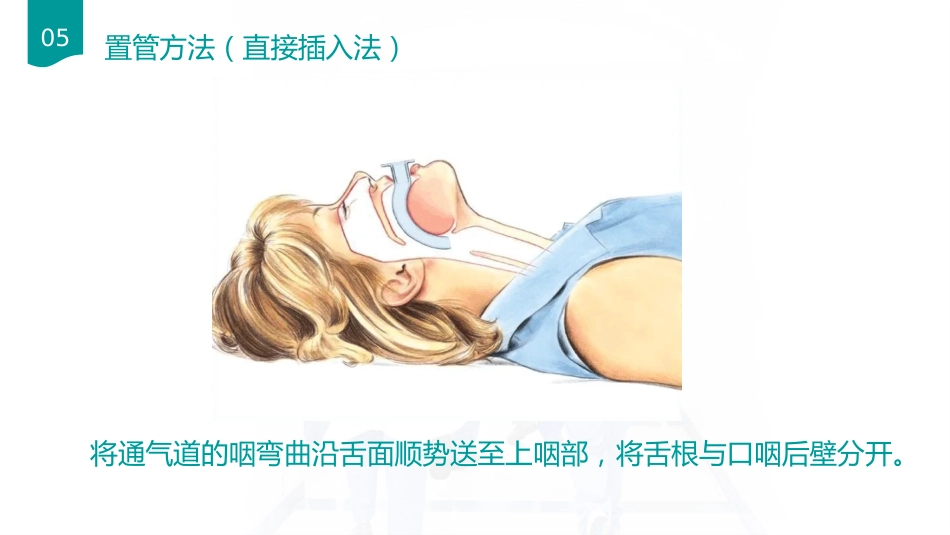 口咽通气放置方法_第7页