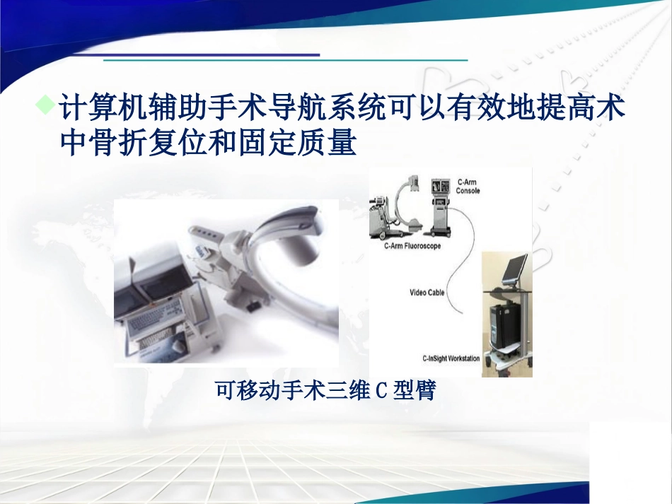 骨盆髋臼骨折的微创治疗_第8页