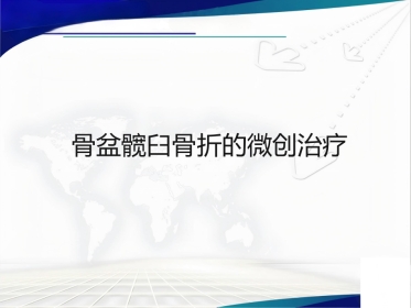 骨盆髋臼骨折的微创治疗