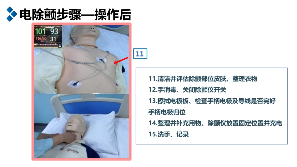 电除颤及简易呼吸器的使用_第13页