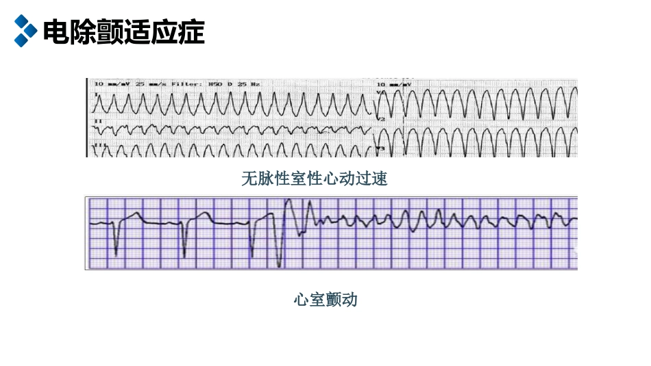 电除颤及简易呼吸器的使用_第6页