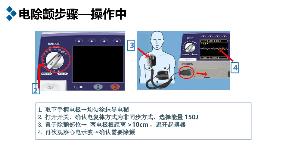 电除颤及简易呼吸器的使用_第9页