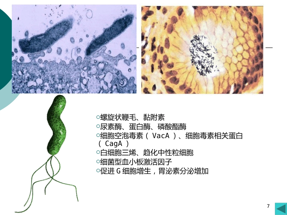 病理学课件PPT 消化系统疾病_第7页