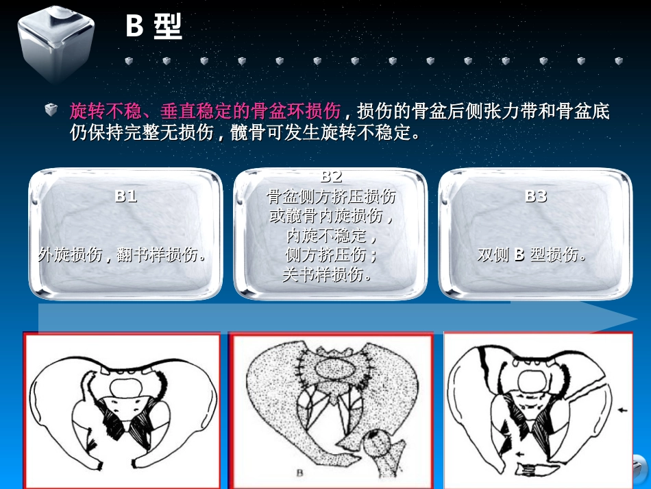 骨盆骨折的分型及治疗_第11页