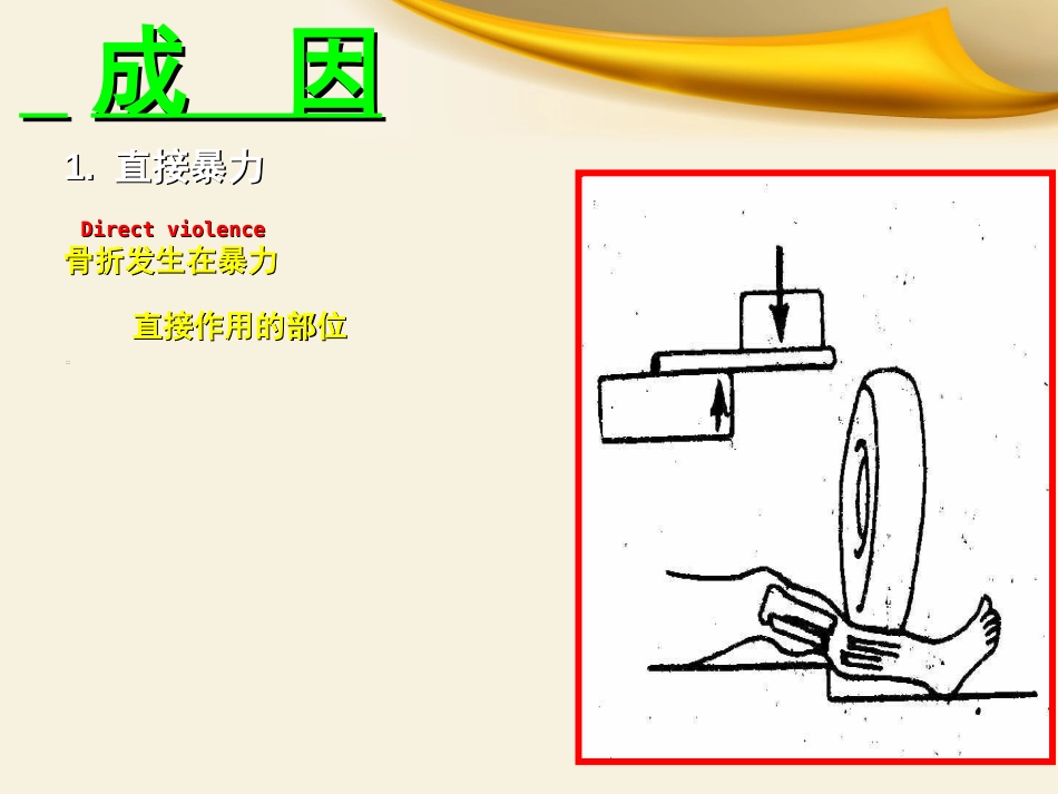 骨科实习小讲课课件_第6页